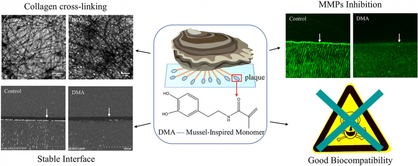 Comparison of the resin-dentin interface using DMA added adhesive and conventional dental adhesive. (set of photos on the left) DMA added adhesive results in a more stable interface. (set of photos on the right) In nanoleakage evaluation,  in the control group, silver particles were observed spreading along the resin-dentin interface and infiltrating inside dentinal tubules after aging. 